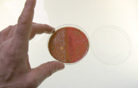 Bacterial culture